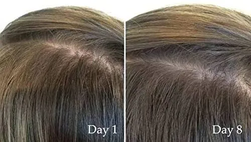 THE ORDINARY

Multi-Peptide Serum For Hair Density 60ml