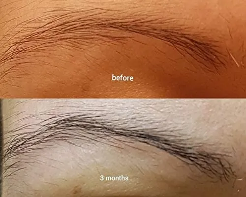 THE ORDINARY

Multi-Peptide Serum For Hair Density 60ml
