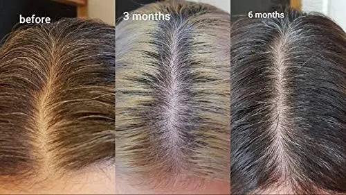 THE ORDINARY

Multi-Peptide Serum For Hair Density 60ml